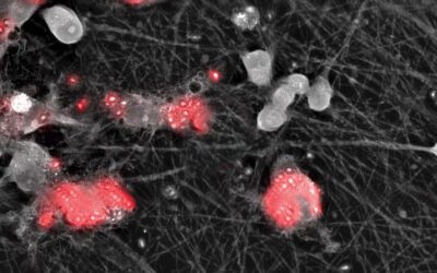 Scientists at King’s College London and bit.bio Collaborate to Develop Multi-Cell Models of the Human Brain