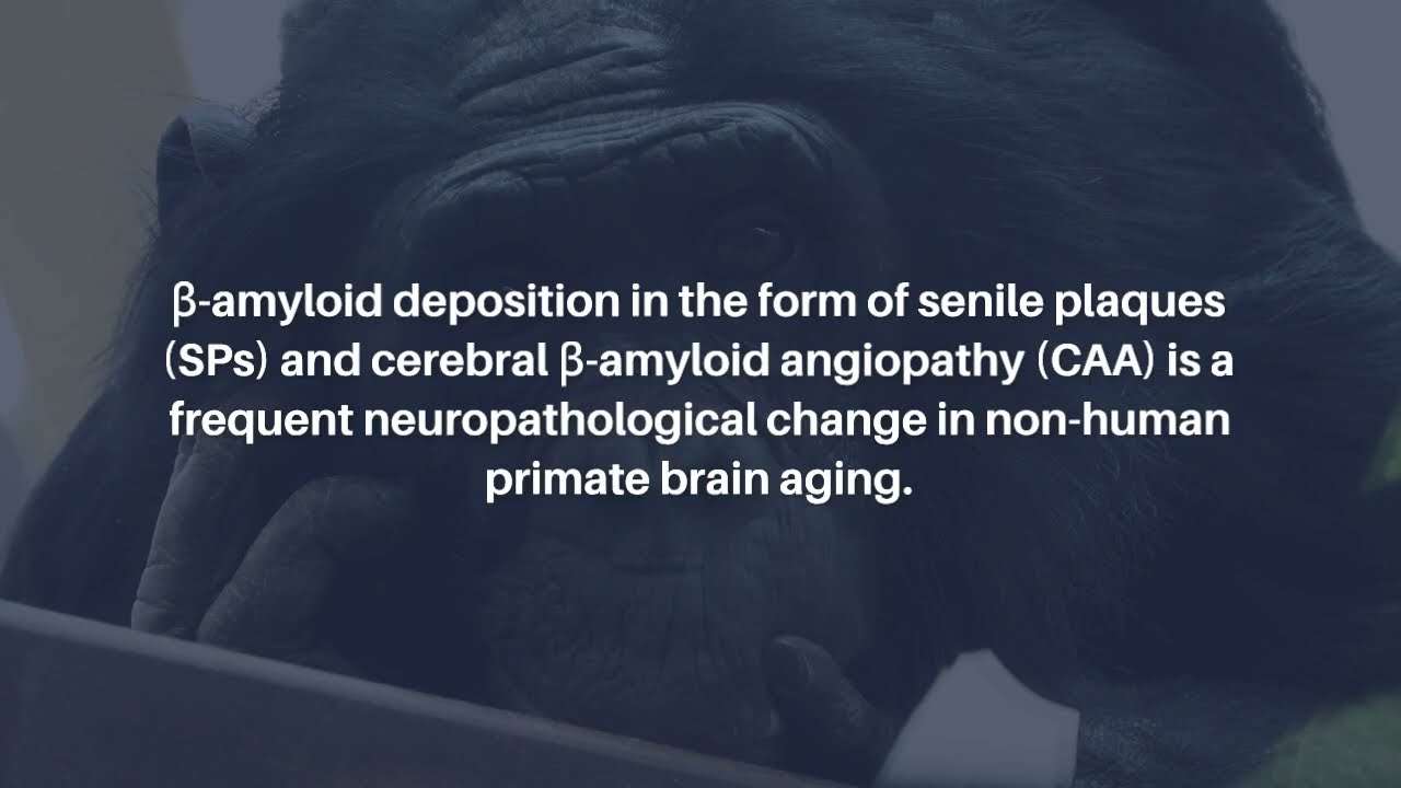 Brain Aging and Alzheimers